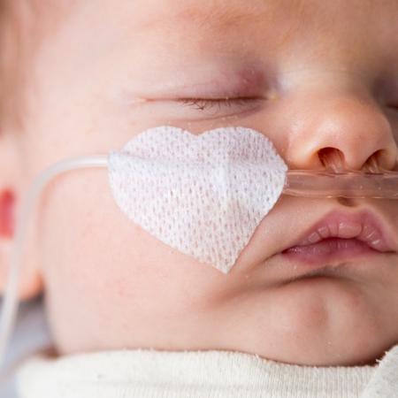 Baby with a breathing tube